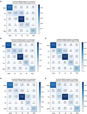 Benchmarking performance of an automatic polysomnography scoring system in a population with suspected sleep disorders